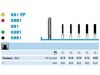 Picture of Diamond Instruments (Cavity/Crown Preparation, Facial surface trimming)