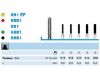 Picture of Komet Diamond Instruments (Cavity/Crown Preparation, Facial surface trimming)